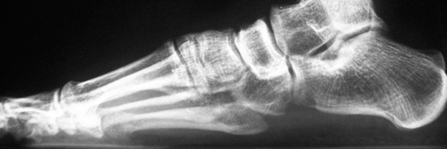 Ponencias y vídeos del I Curso Artroscopia Tobillo y pie