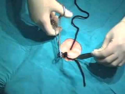 Técnicas enfermería: Inicio suturua contínua