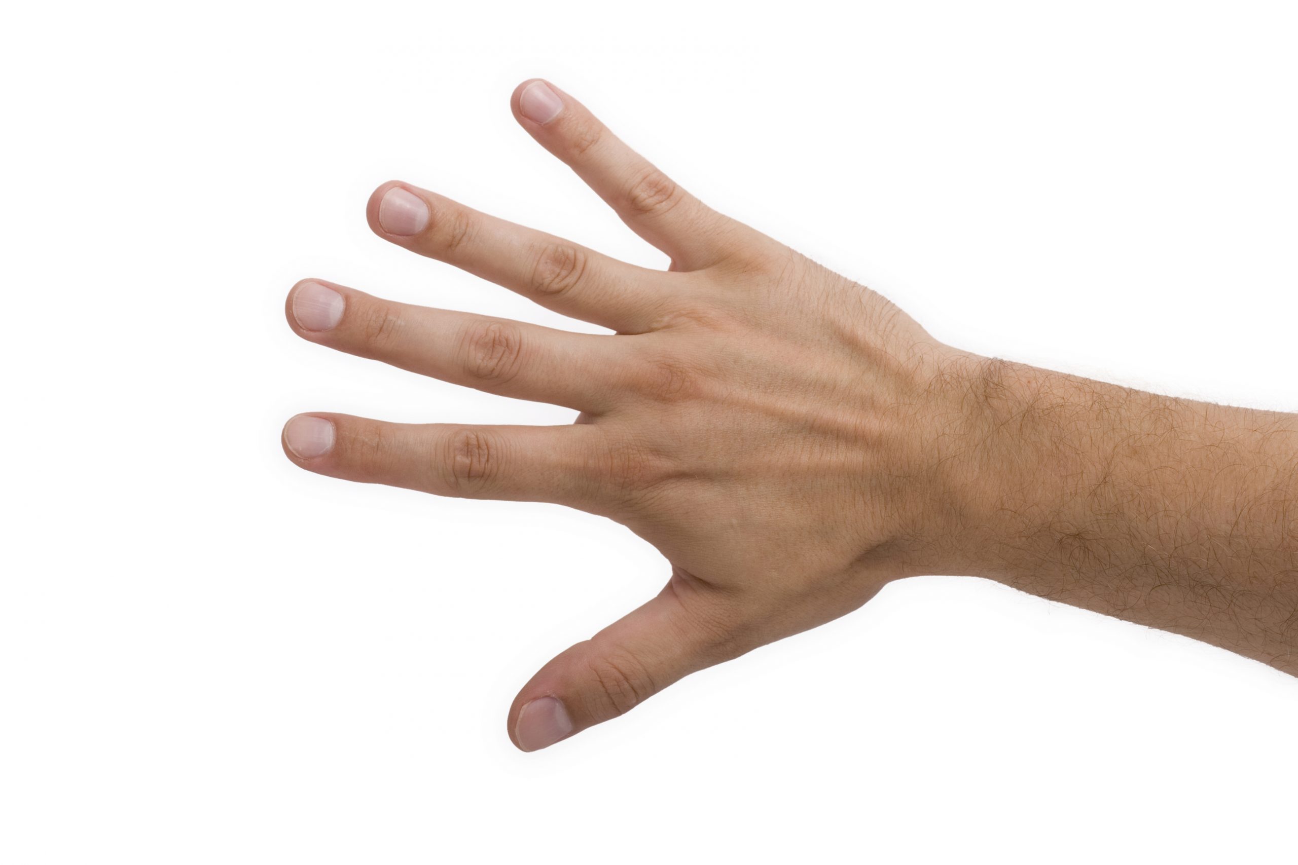 Polvoriento pago tema Lesiones en los tendones extensores de la mano - Asepeyo salud