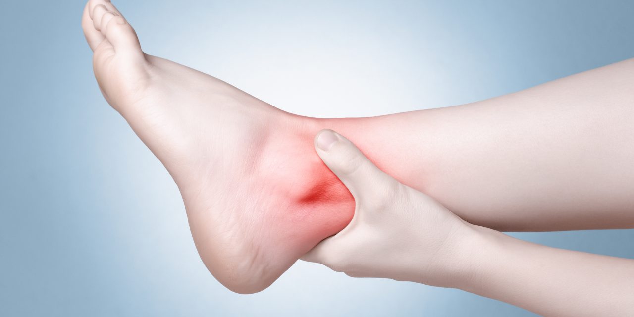 Esguinces de tobillo y Enfermedad Tromboembólica Venosa (ETV).  Comparación con pacientes con artroplastia de rodilla.